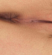 Clover-a-Doctor’s-Dream